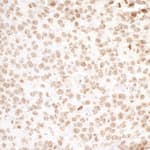 Detection of mouse H2AX by immunohistochemistry.