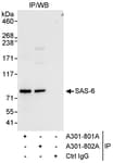 Detection of human SAS-6 by western blot of immunoprecipitates.