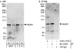 Detection of human MUM1 by western blot and immunoprecipitation.