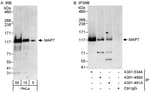 Detection of human MAP7 by western blot and immunoprecipitation.