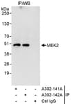 Detection of human MEK2 by western blot of immunoprecipitates.