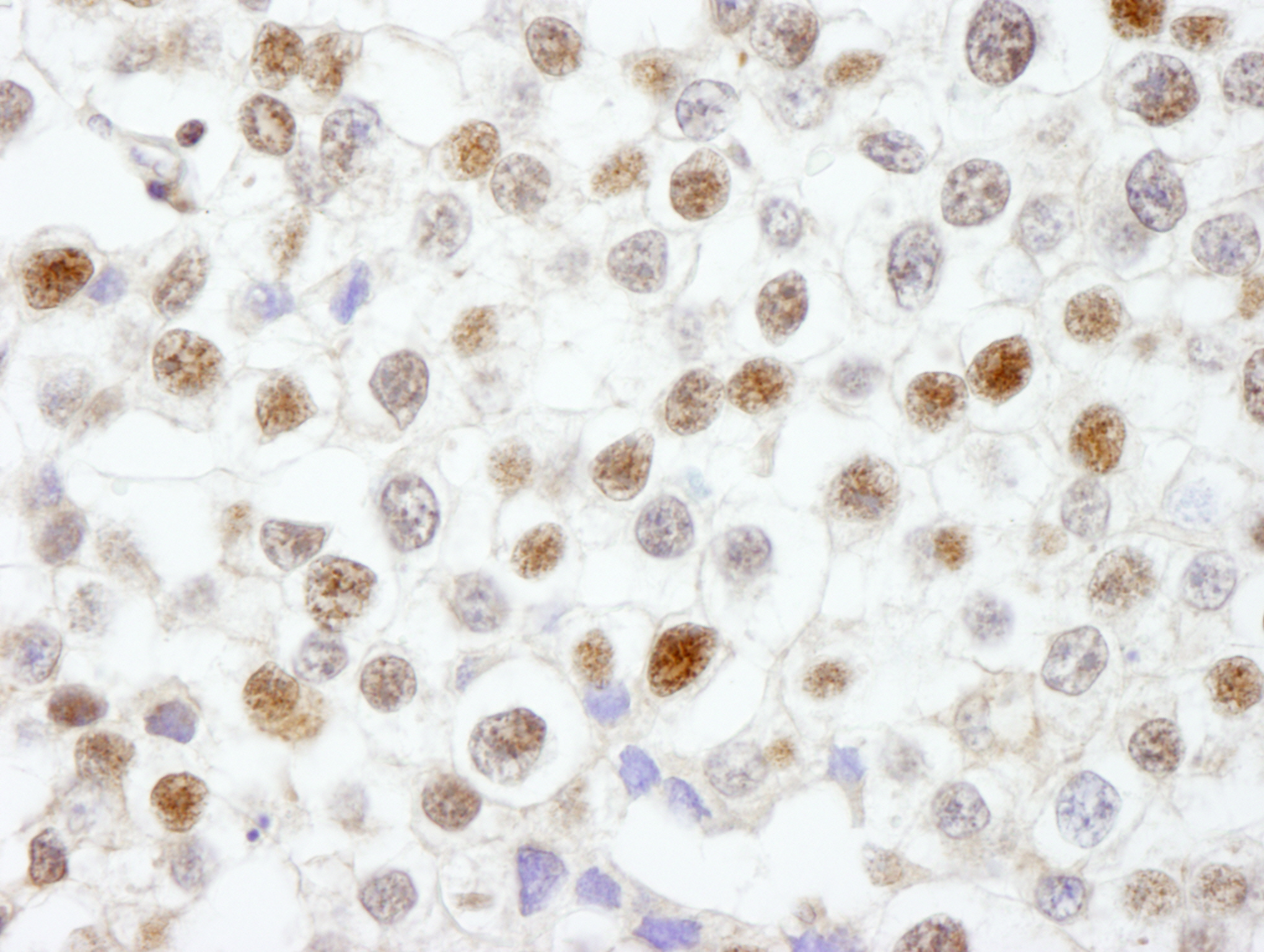 Rabbit anti-Fen1 IHC Antibody