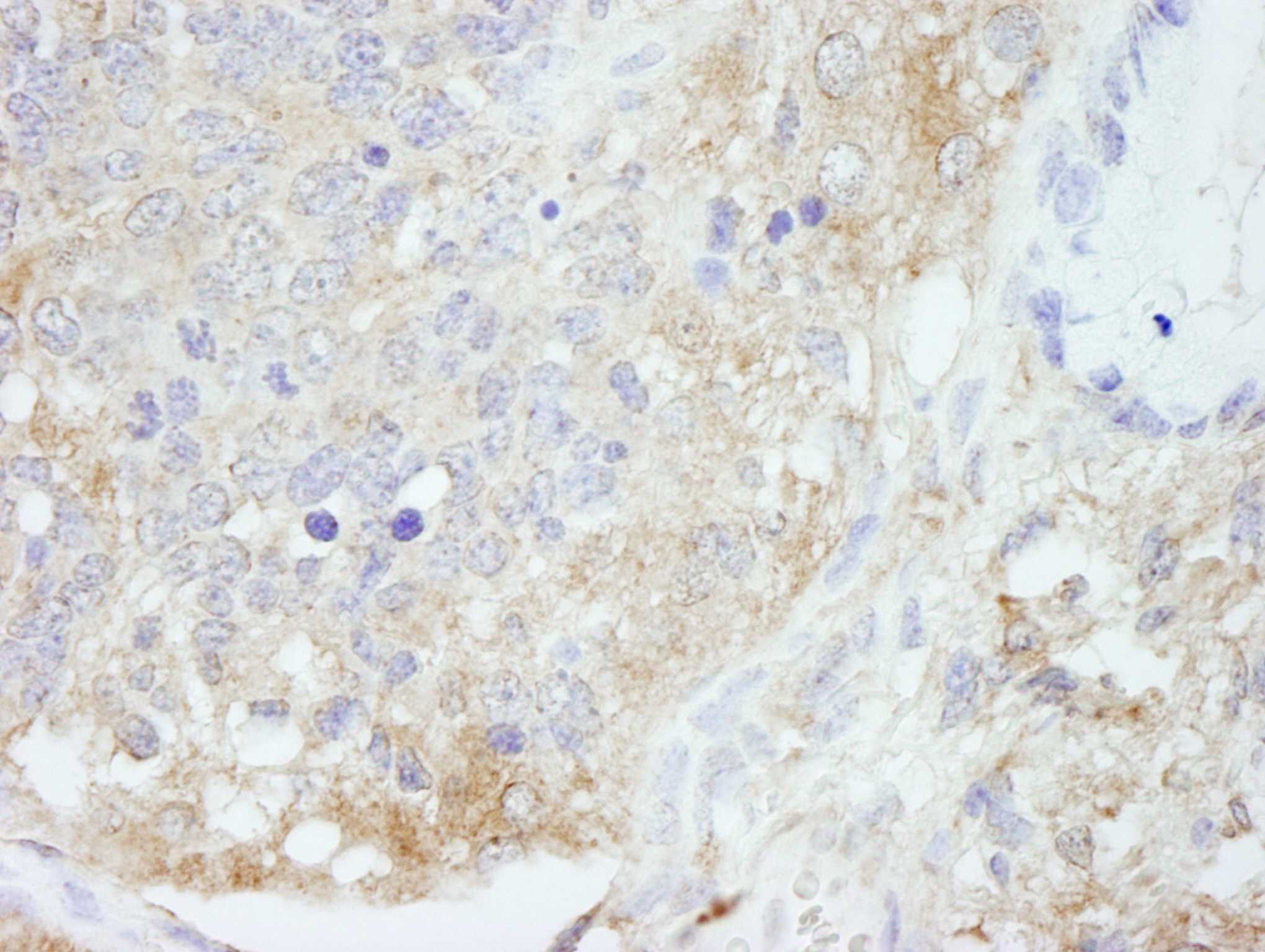 Detection of mouse HPIP by immunohistochemistry.