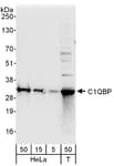 Detection of human C1QBP by western blot.