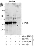 Detection of human PA1 by western blot of immunoprecipitates.