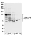Detection of human and mouse ARHGAP17 by western blot.