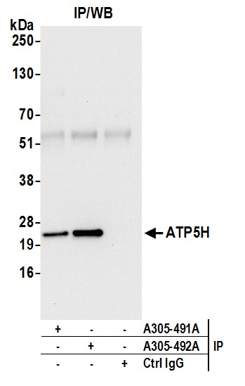 Detection of human ATP5H by western blot of immunoprecipitates.