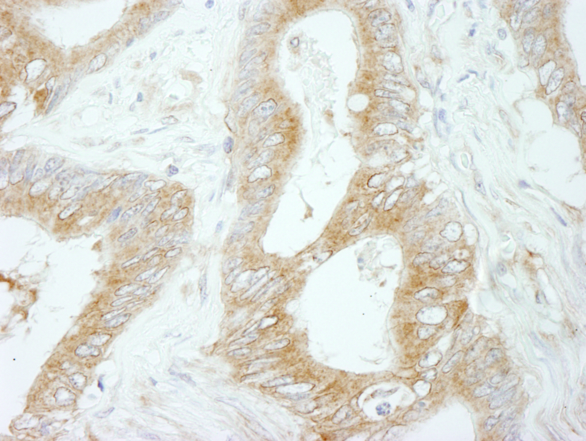 Detection of human Flightless-1 by immunohistochemistry.