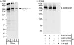 Detection of human CCDC131 by western blot and immunoprecipitation.