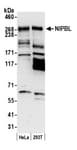 Detection of human NIPBL by western blot.