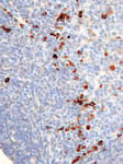 Detection of human Kappa by immunohistochemistry.