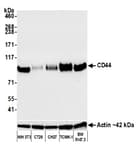 Detection of mouse CD44 by western blot.