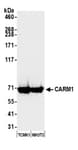 Detection of mouse CARM1 by western blot.