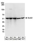 Detection of human and mouse Sec62 by western blot.