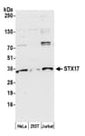 Detection of human STX17 by western blot.