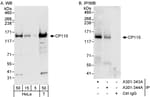 Detection of human CP110 by western blot and immunoprecipitation.