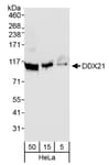 Detection of human DDX21 by western blot.