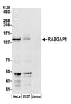 Detection of human RABGAP1 by western blot.