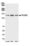 Detection of human PLCG2 by western blot.