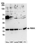 Detection of human and mouse PMVK by western blot.