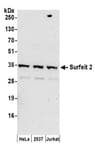 Detection of human Surfeit 2 by western blot.