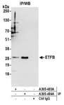Detection of human ETFB by western blot of immunoprecipitates.