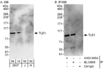 Detection of human TLE1 by western blot and immunoprecipitation.