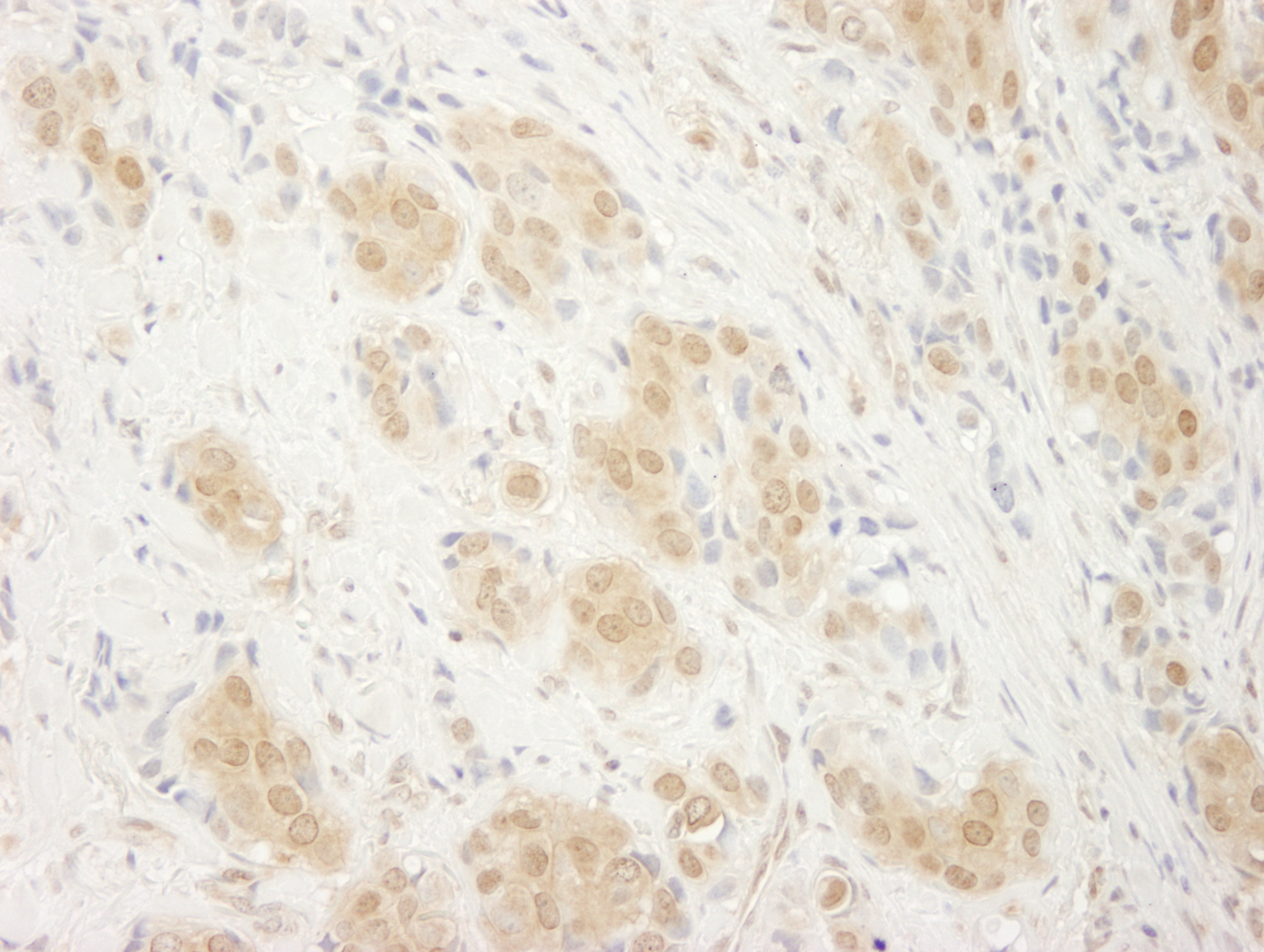 Rabbit anti-ERK2 IHC Antibody