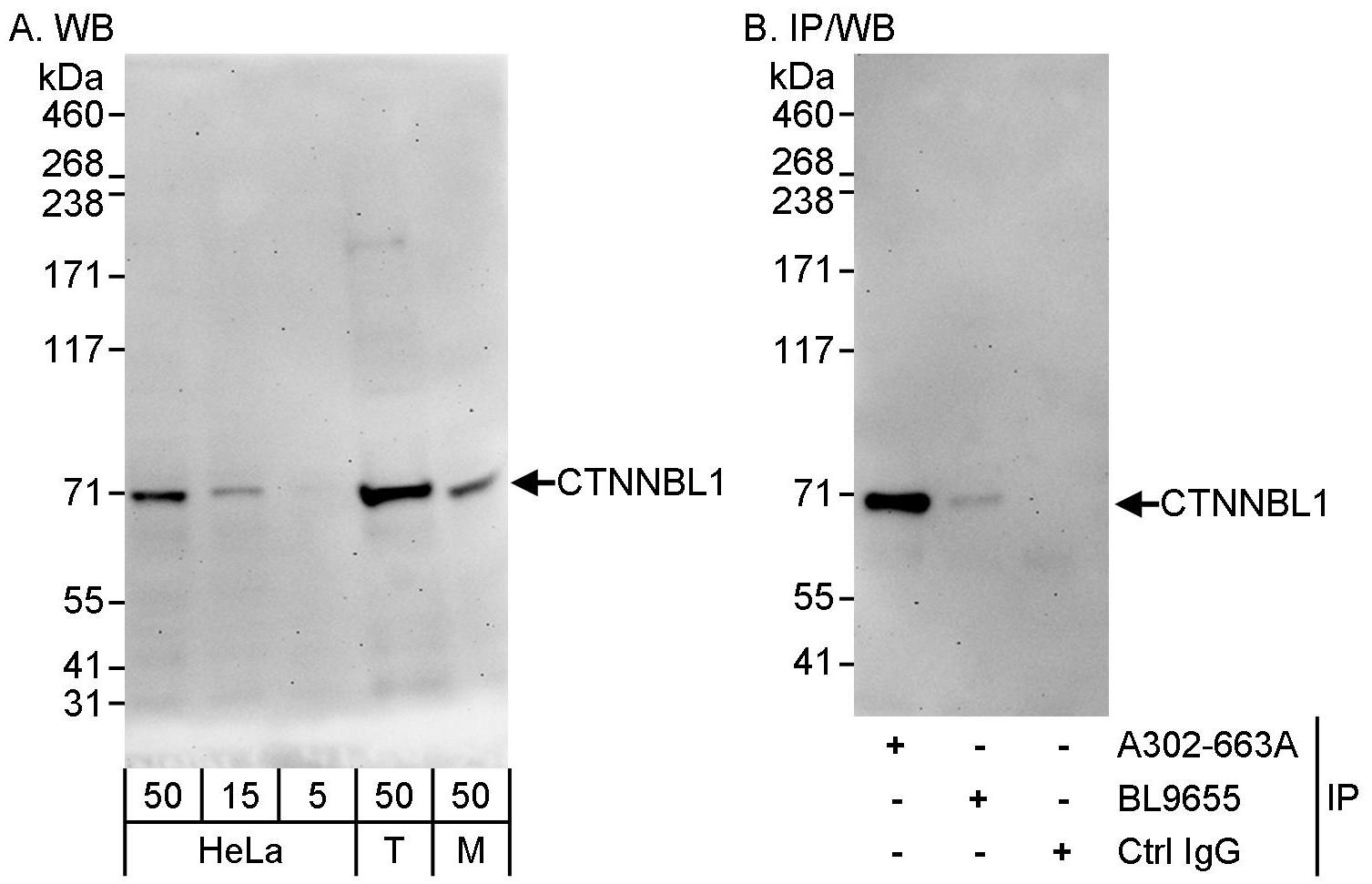 Detection of human and mouse CTNNBL1 by western blot (h&amp;m) and immunoprecipitation (h).