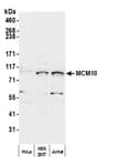 Detection of human MCM10 by western blot.