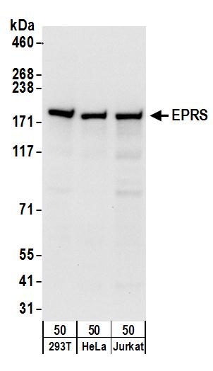 Detection of human EPRS by western blot.