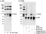 Detection of human TPX2 by western blot and immunoprecipitation.