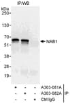 Detection of human NAB1 by western blot of immunoprecipitates.