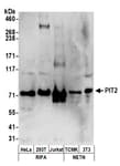 Detection of human and mouse PIT2 by western blot.