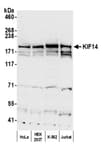 Detection of human KIF14 by western blot.