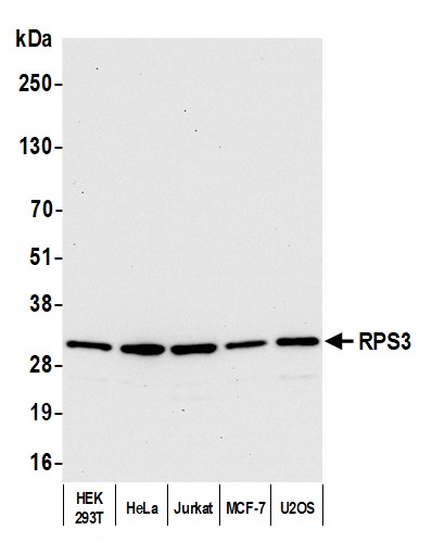 Detection of human RPS3 by western blot.