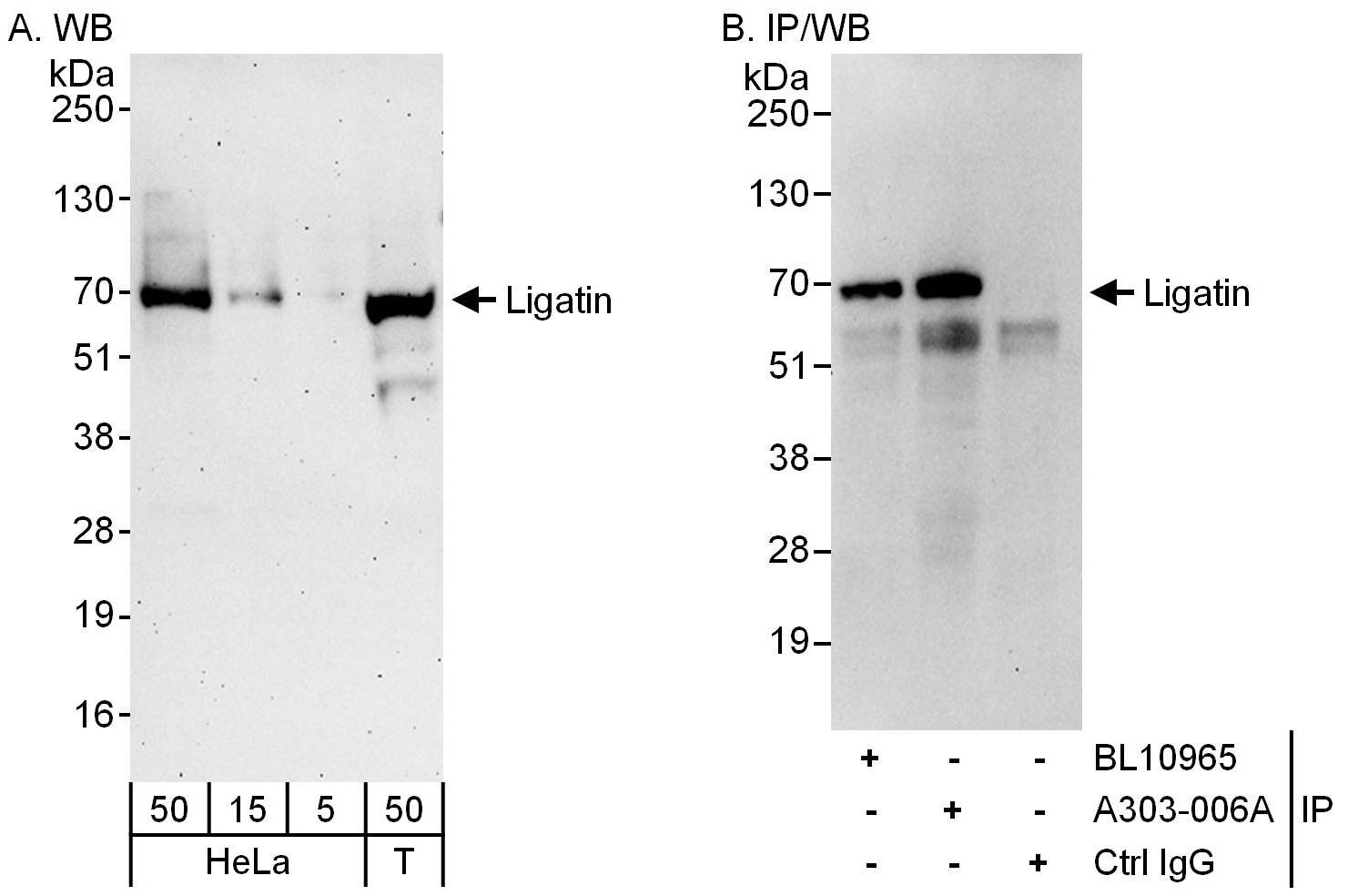 Detection of human Ligatin by western blot and immunoprecipitation.