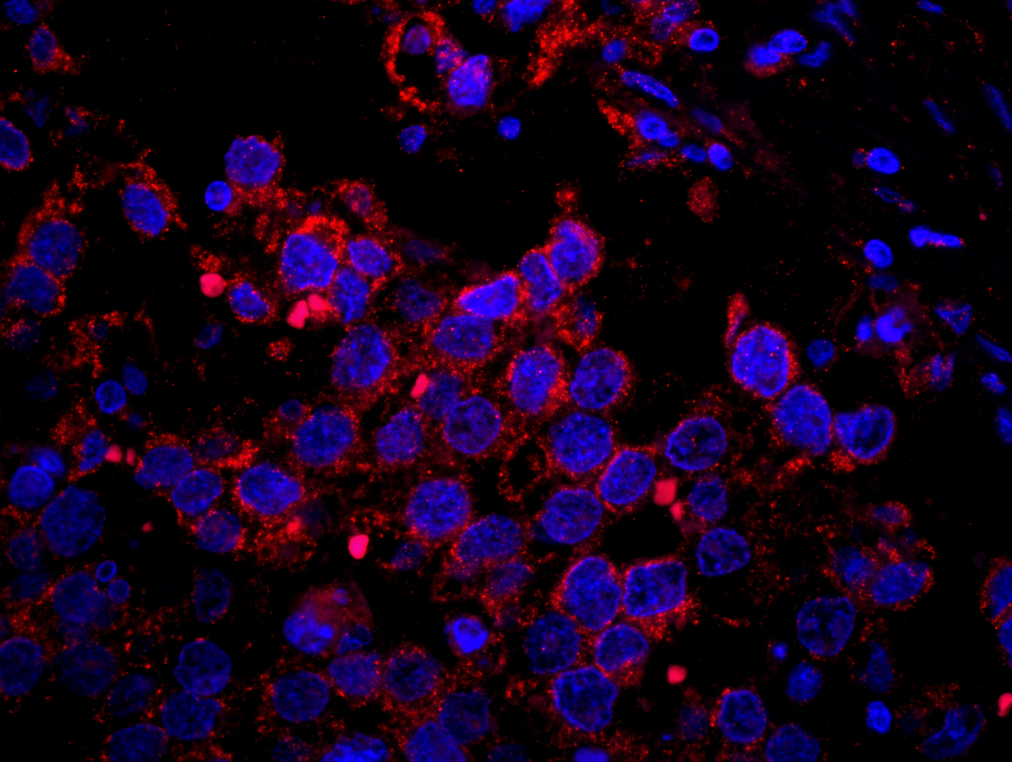 Rabbit anti-IRS2 IHC Antibody
