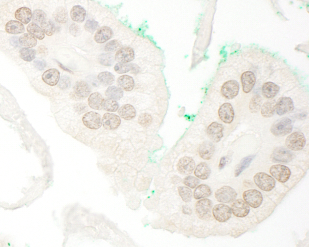 Rabbit anti-ARA70 IHC Antibody