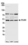 Detection of human PLIN3 by western blot.