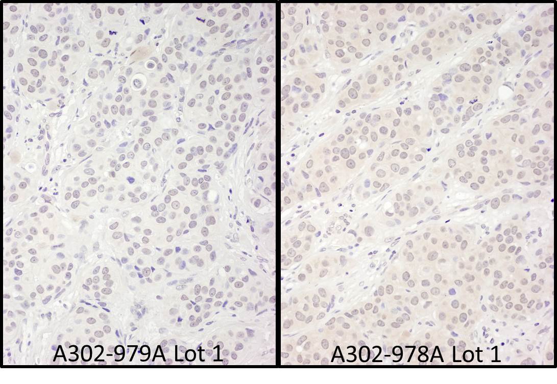 Detection of human DDX56 by immunohistochemistry.