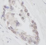 Detection of human RNF40 by immunohistochemistry.