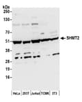 Detection of human and mouse SHMT2 by western blot.