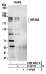 Detection of human KIF20B by western blot of immunoprecipitates.