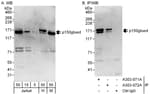 Detection of human and mouse p150glued by western blot (h &amp; m) and immunoprecipitation (h).