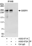 Detection of human QSER1 by western blot of immunoprecipitates.