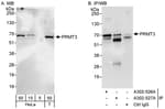 Detection of human PRMT3 by western blot and immunoprecipitation.