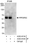 Detection of human PPP2R5C by western blot of immunoprecipitates.