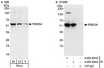 Detection of human RBM34 by western blot and immunoprecipitation.