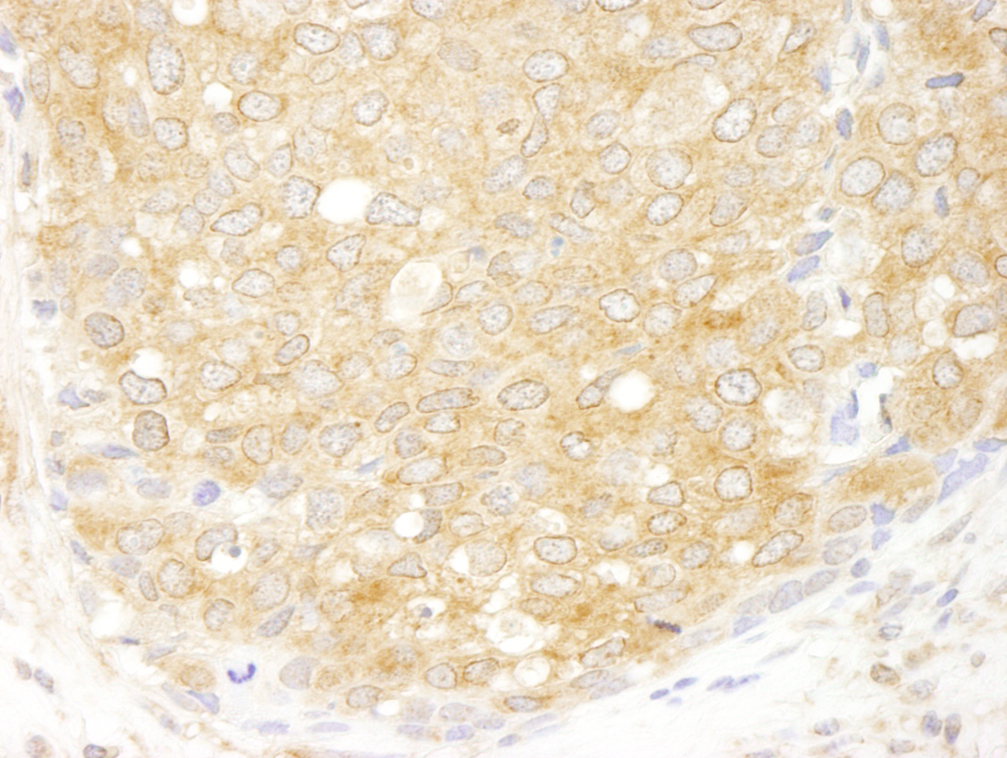 Rabbit anti-eIF2beta/EIF2S2 IHC Antibody